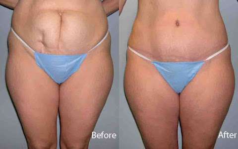 Face and Body Plastic Surgery, P.C.